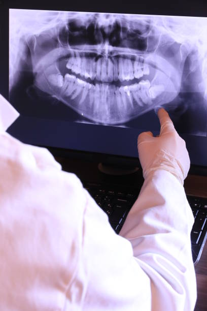 Best Broken or Chipped Tooth Repair in Clinton, NC